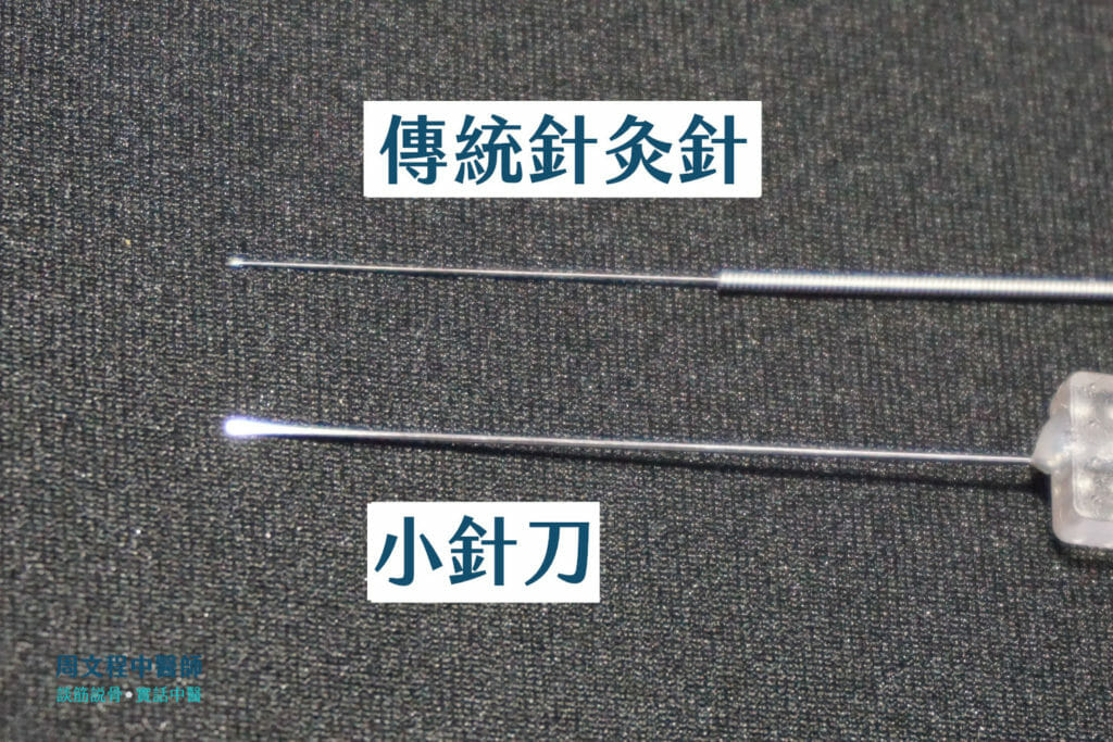 小針刀與傳統針灸針比較，針尖為扁平小刃面