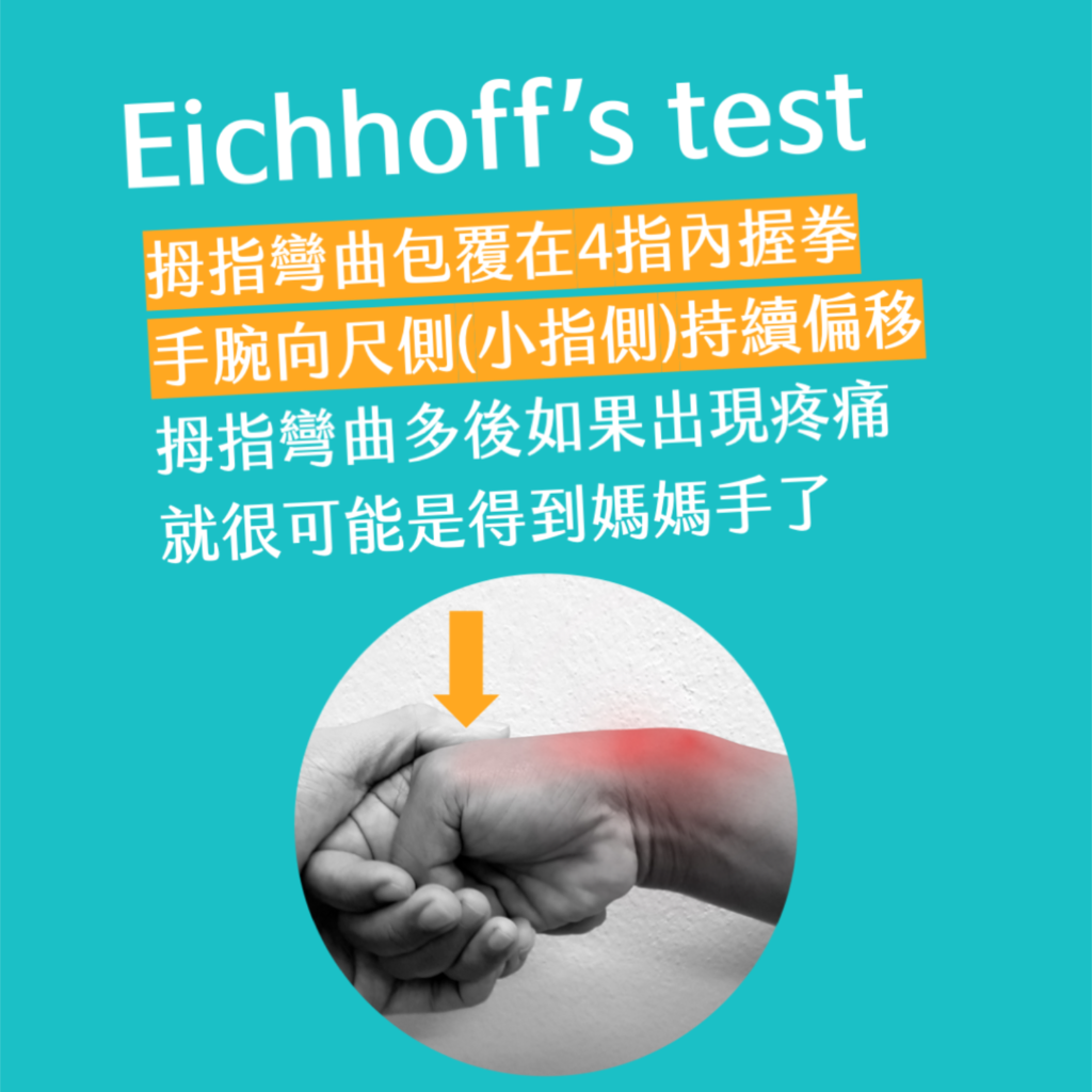 Eichhoff's test